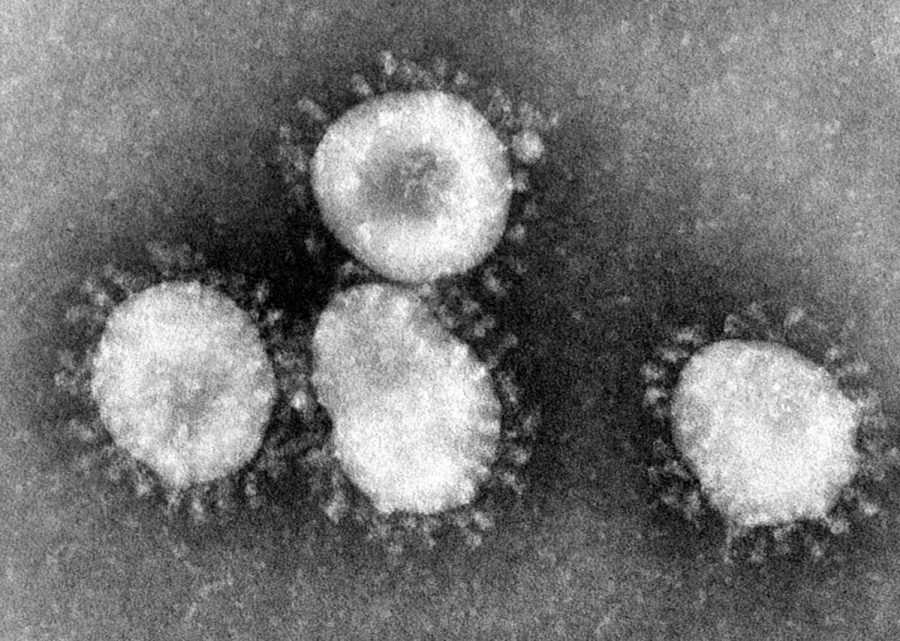 Coronaviruses are a group of viruses that have a halo, or crown-like (corona) appearance when viewed under an electron microscope. [CDC/Dr. Fred Murphy]